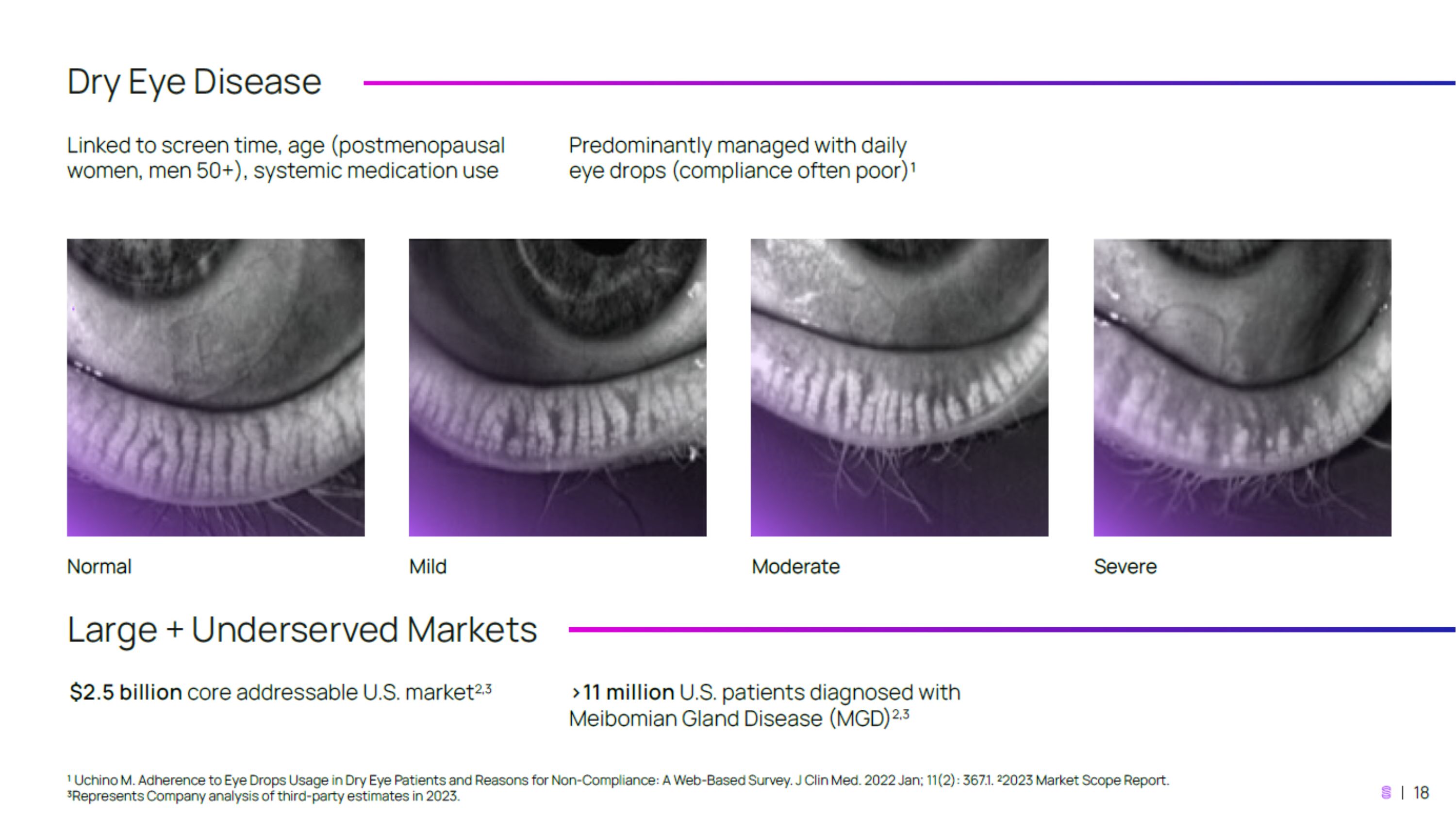 Slide 18