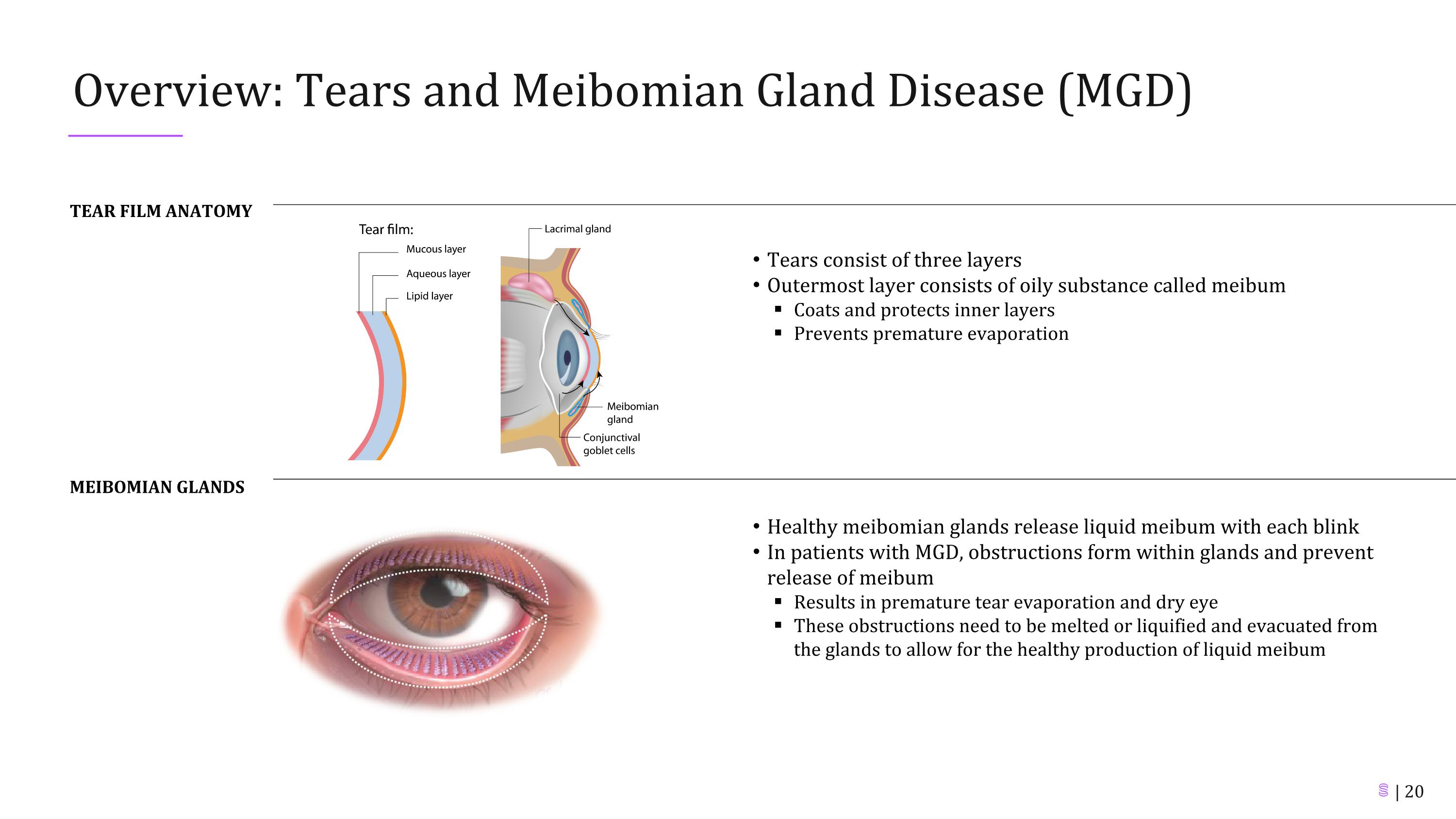 Slide 20