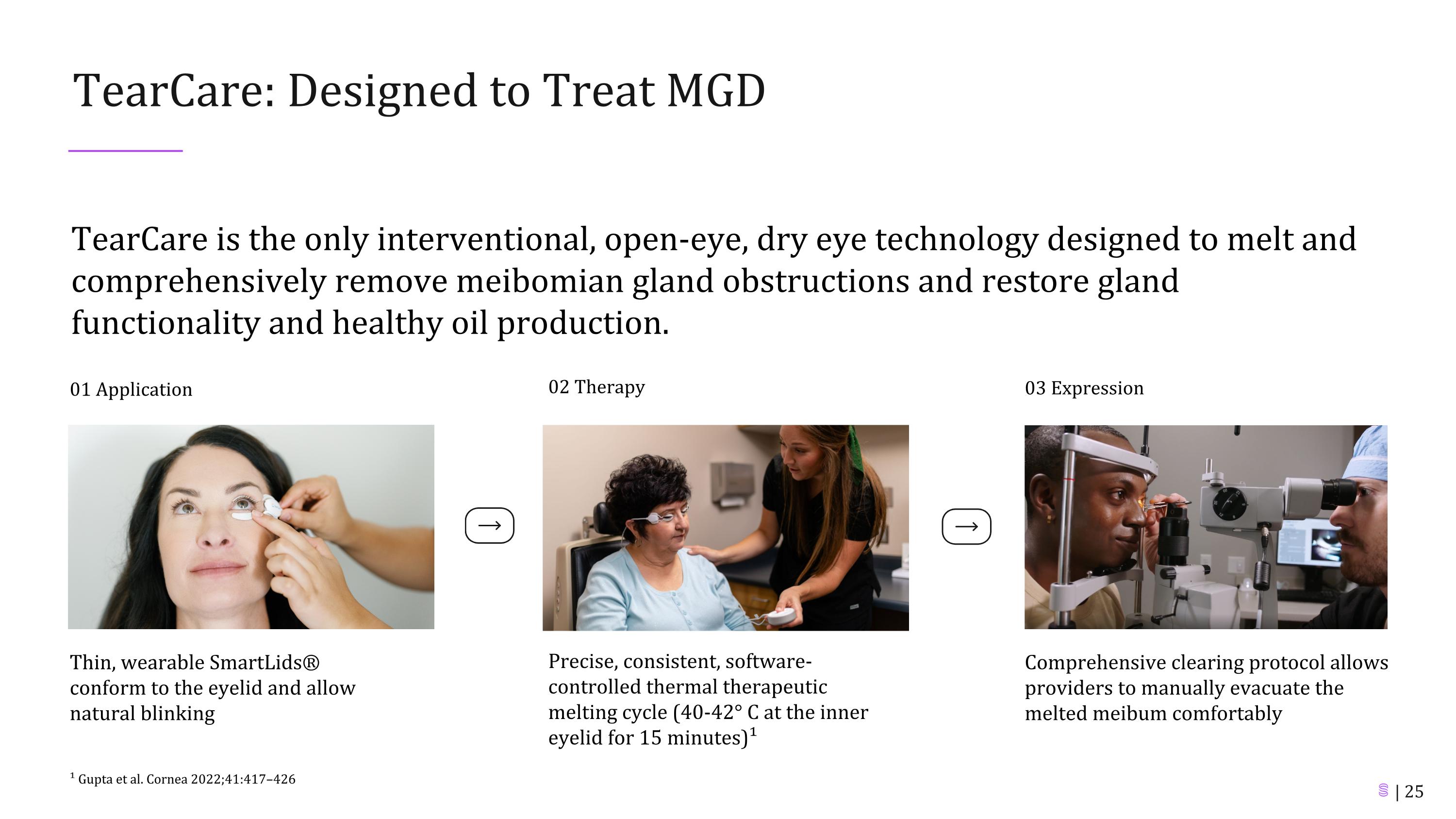 Slide 25