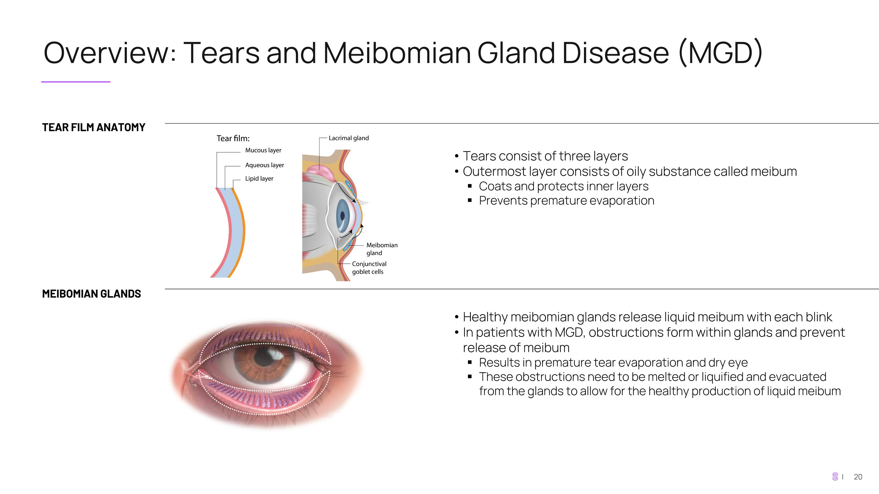 Slide 20