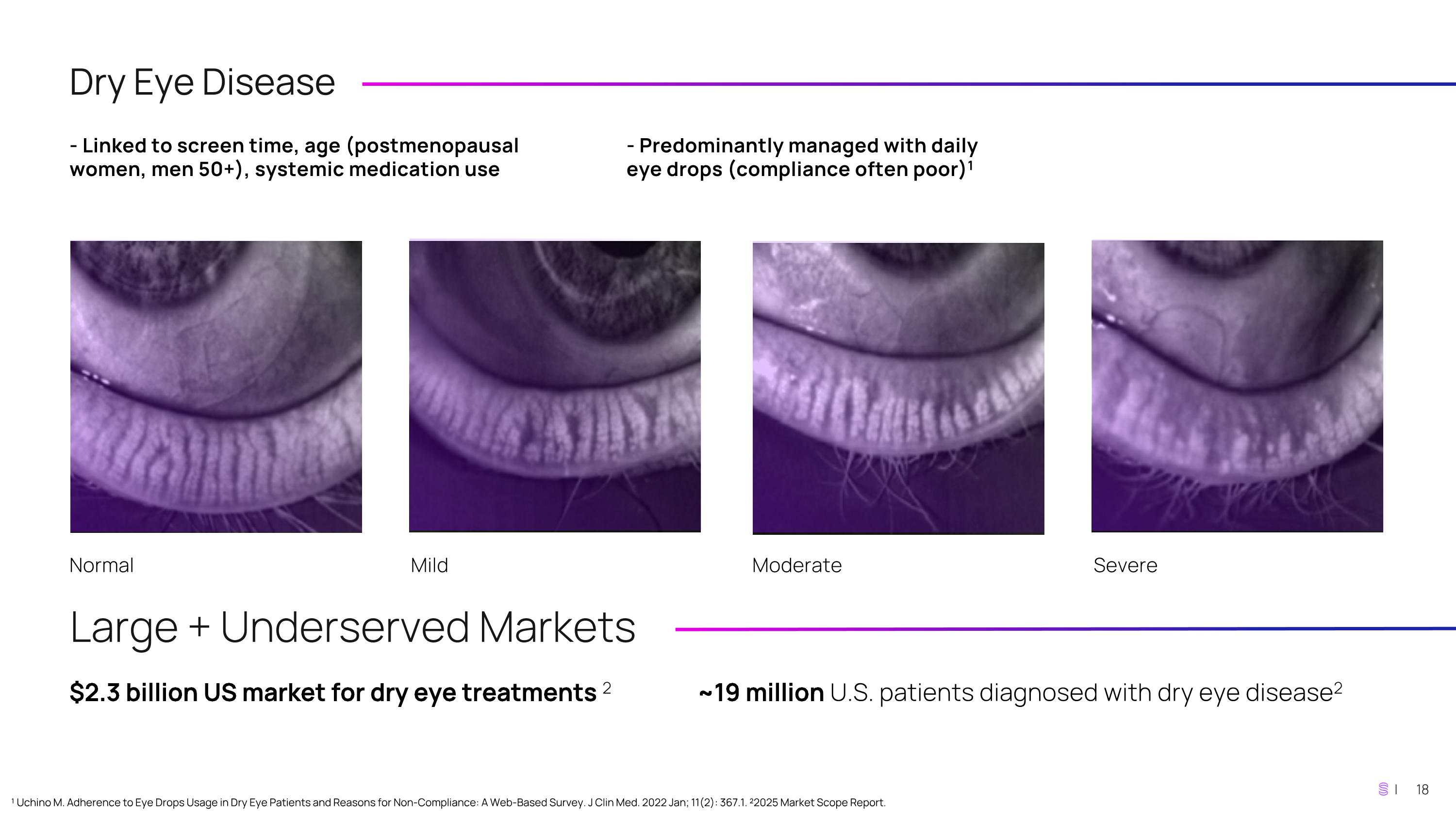 Slide 18
