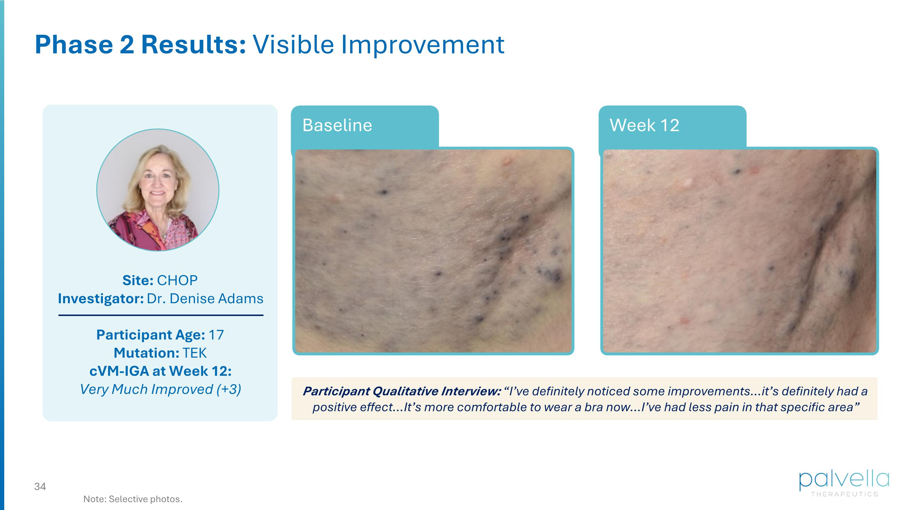 Slide 34