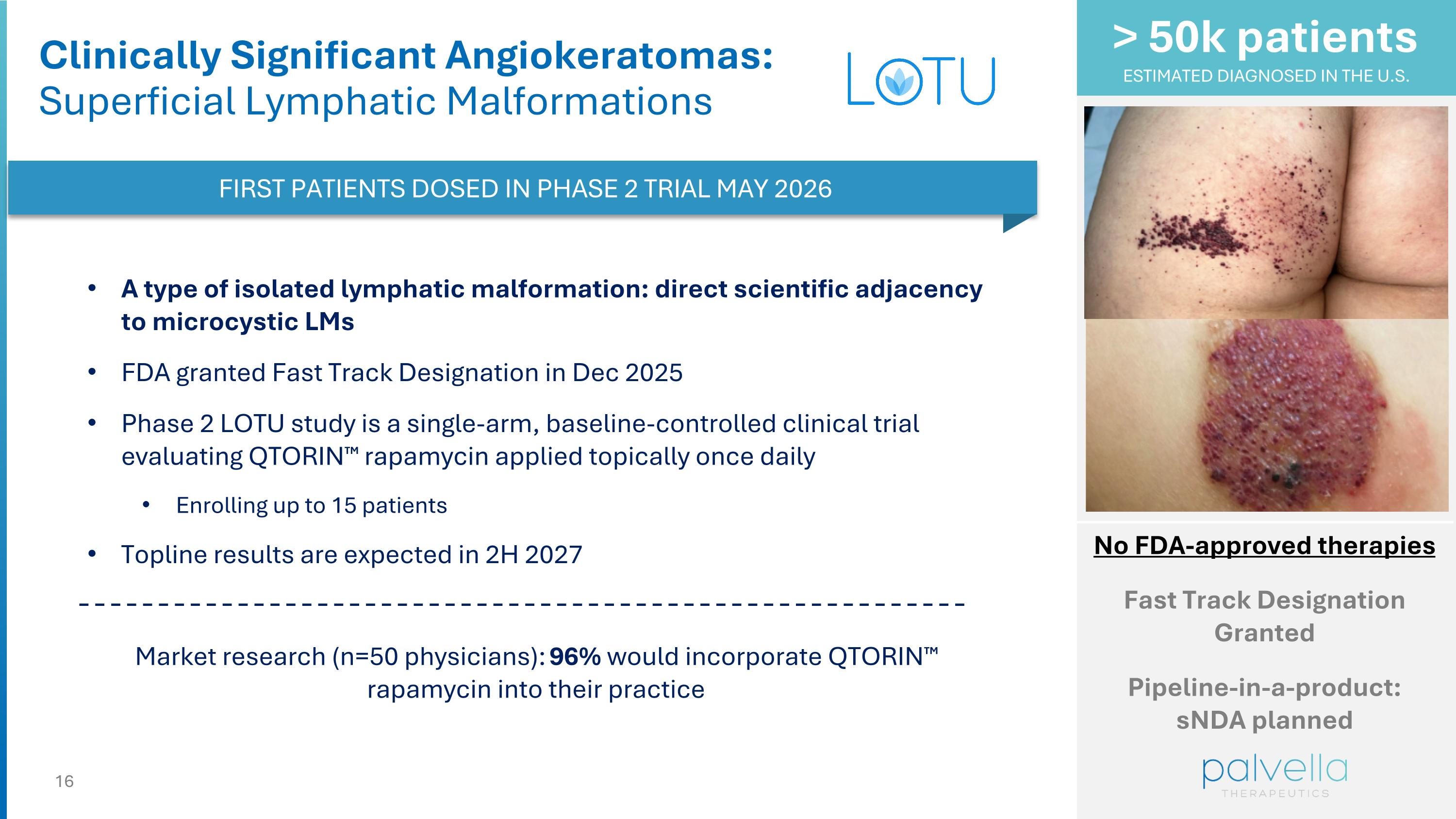 Slide 16