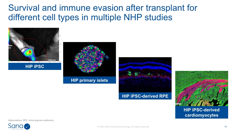 Slide 11