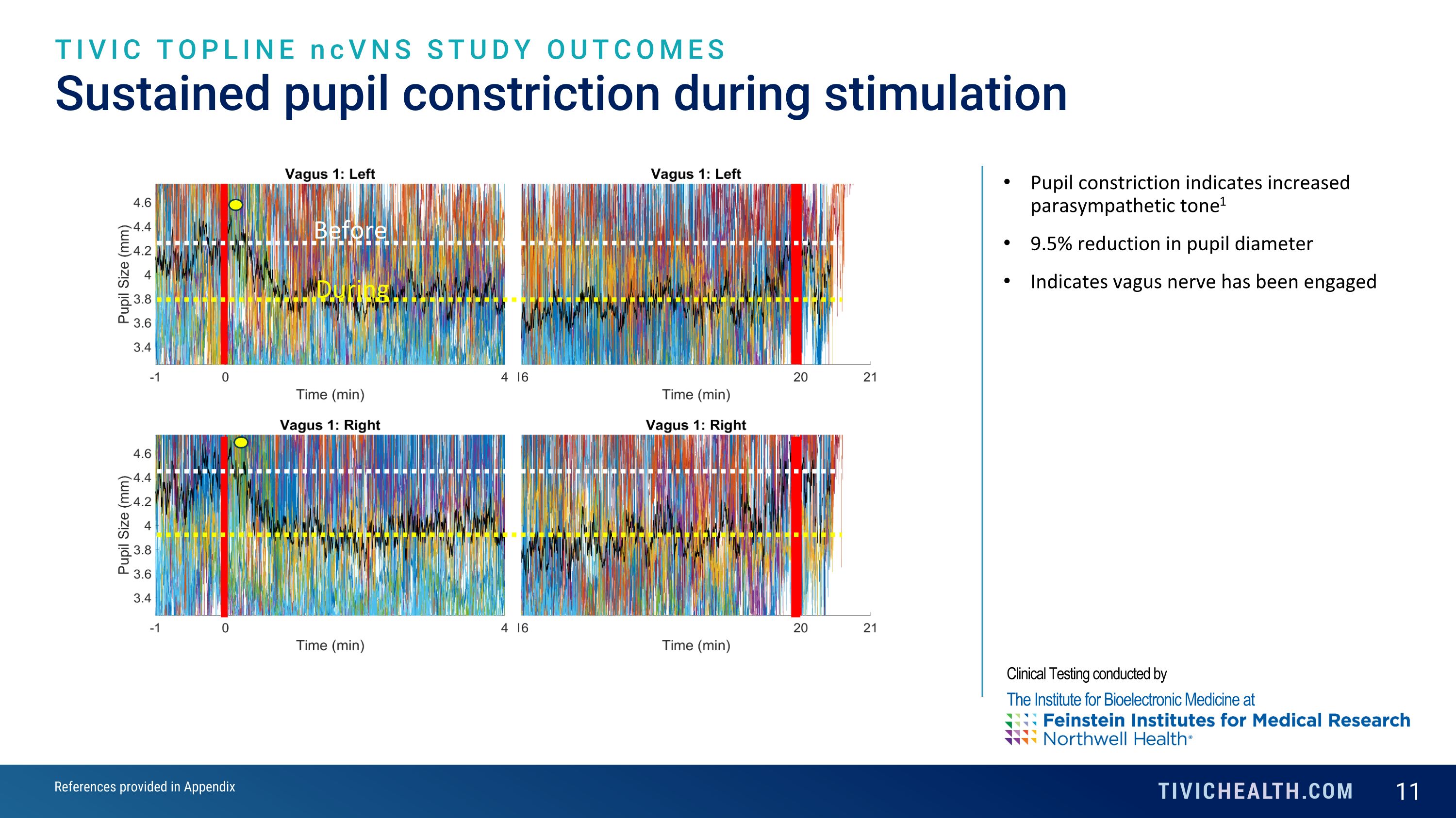 Slide 11