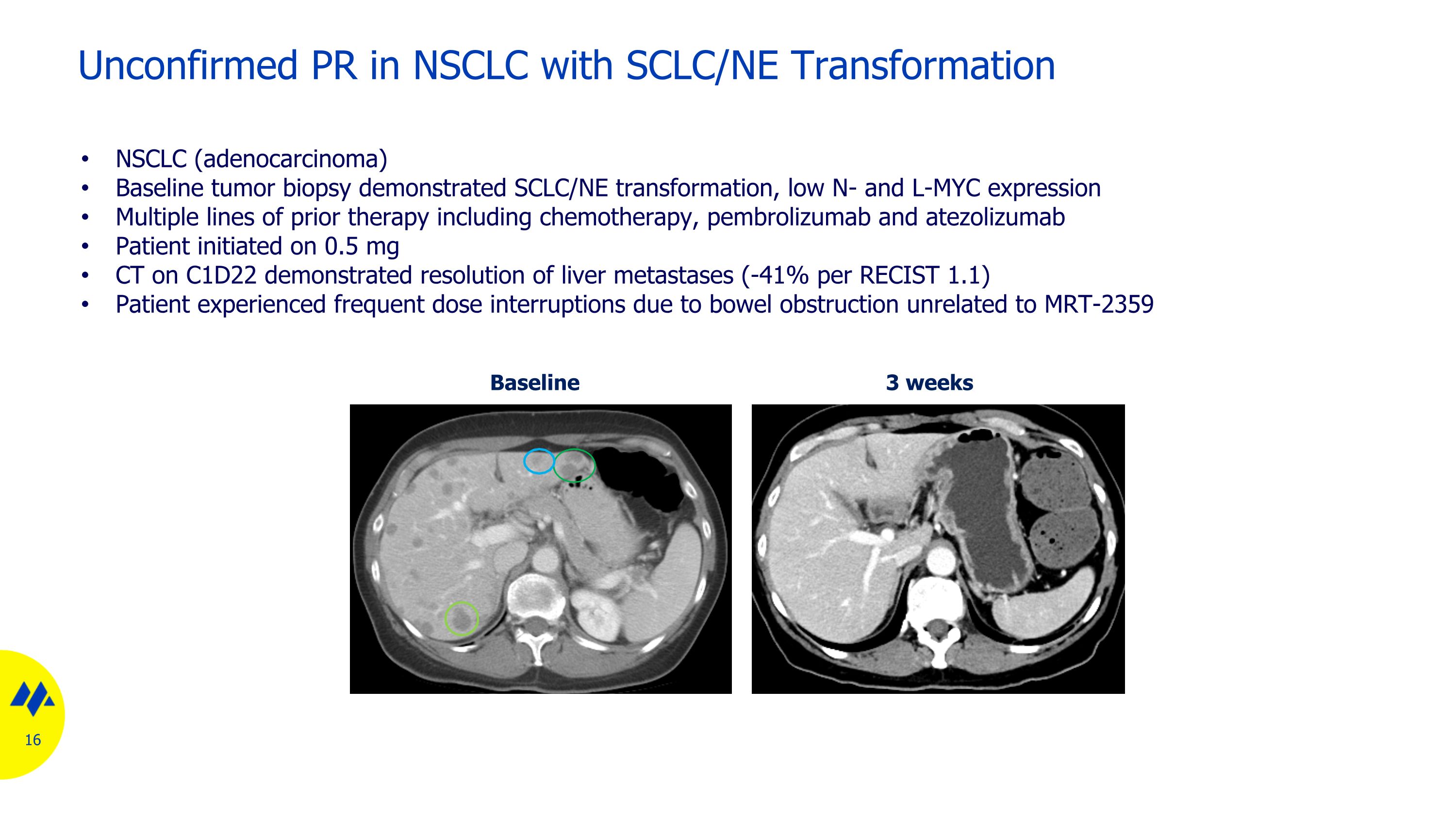 Slide 16