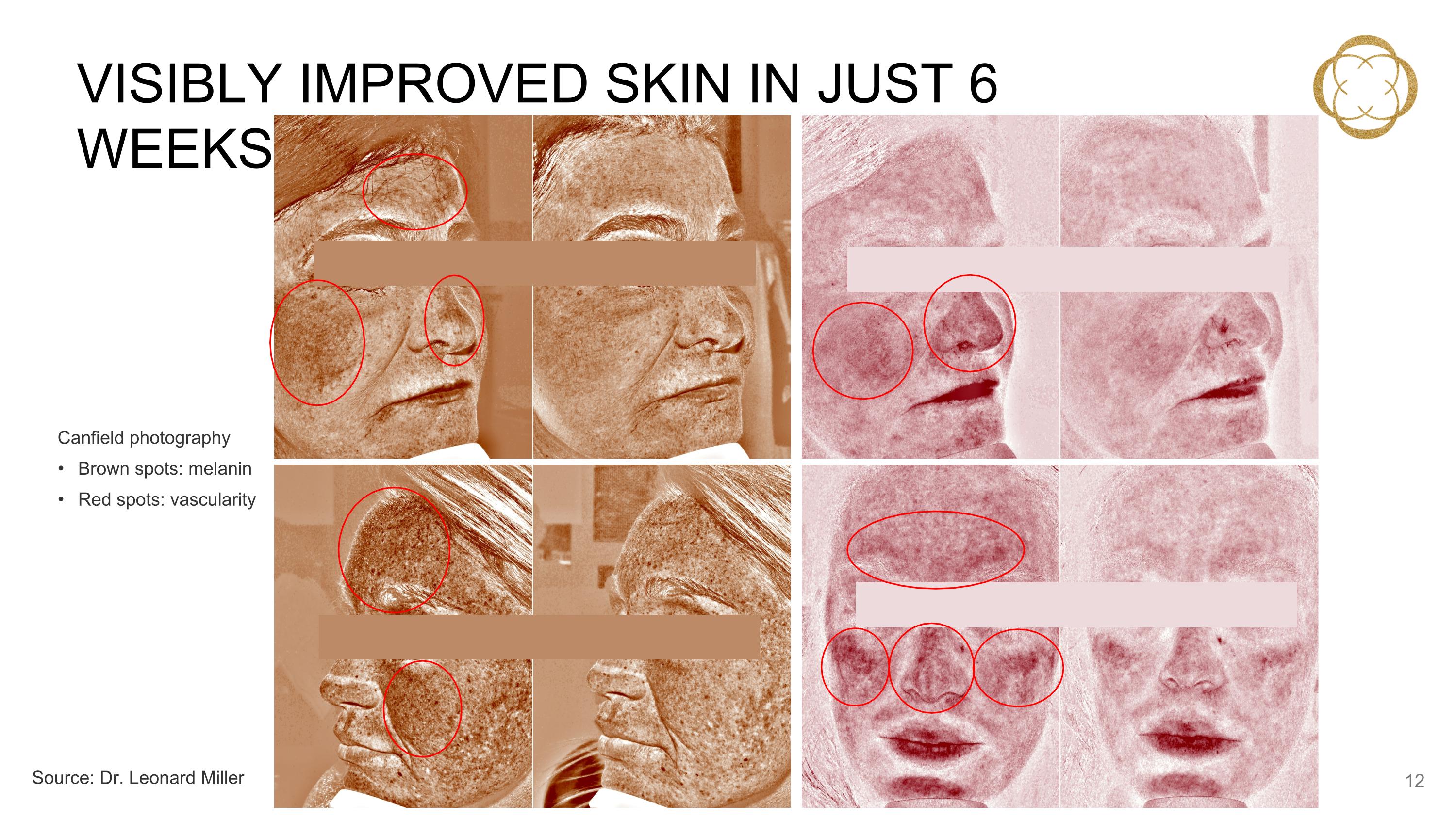 Slide 13